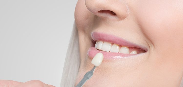 Greater York Family Dentistry- Dental Crowns and Bridges