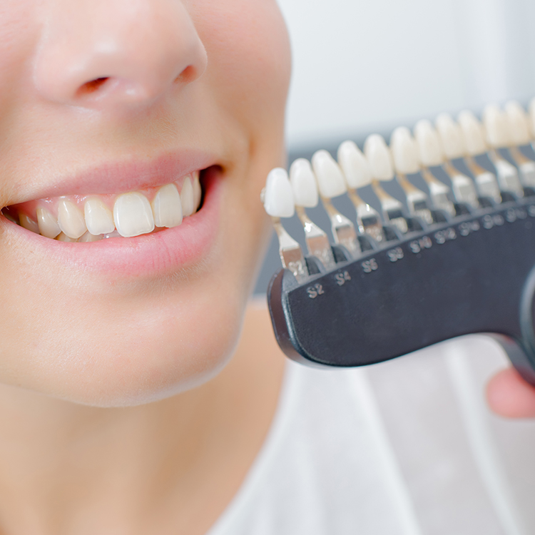 Veneers and Laminates Greater York Family Dentistry