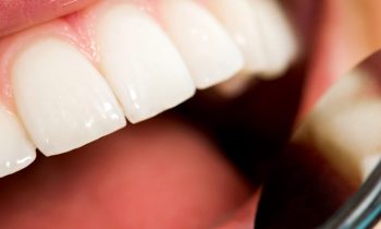 Greater York Family Dentistry- Composite Fillings